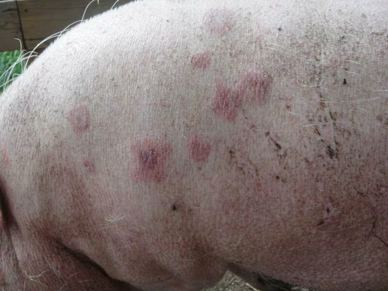 initial welts from erysipelas